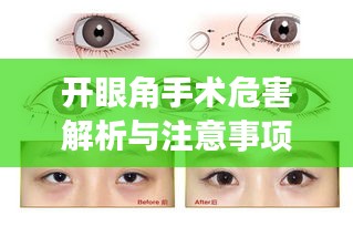開眼角手術(shù)危害解析與注意事項(xiàng)指南——百度健康知識分享